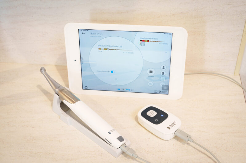 口腔内カメラ｜富谷市の杜の丘デンタルクリニック